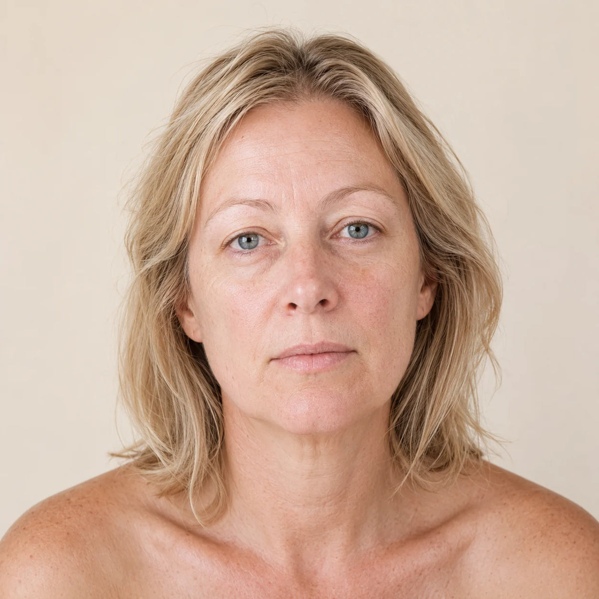 Vorher